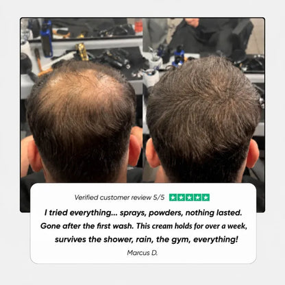 Gelorra - Hair Density Cream