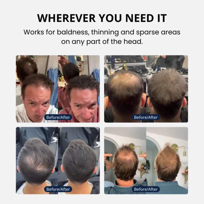 Gelorra - Hair Density Cream